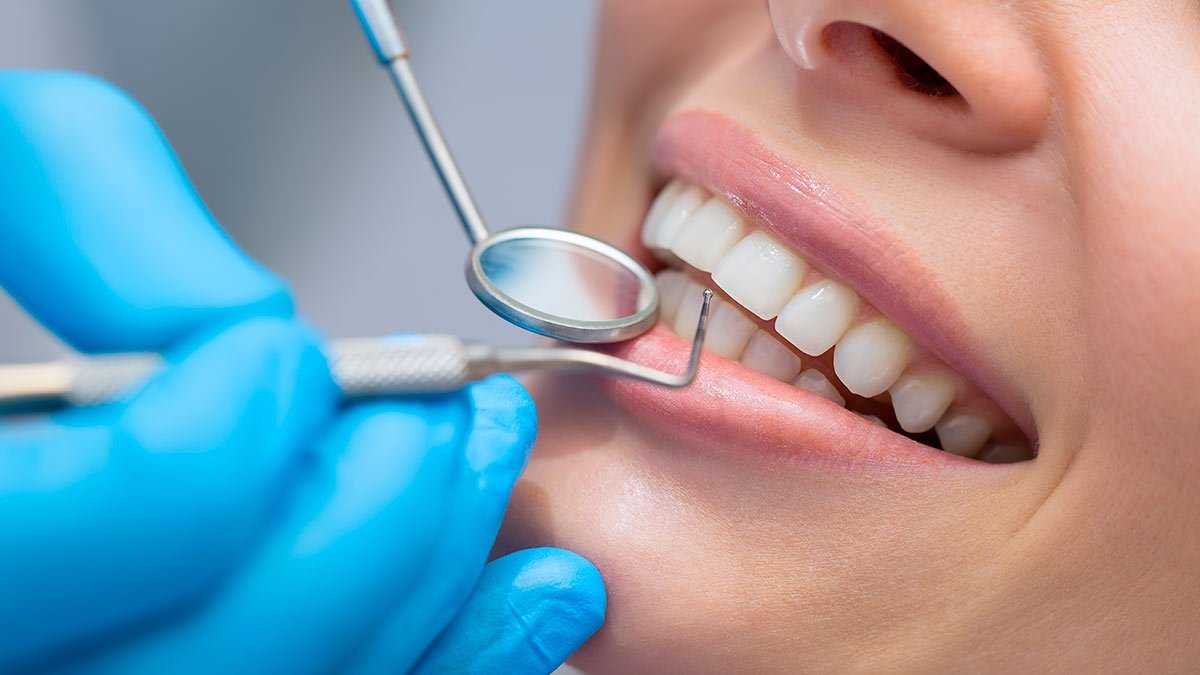 ‍⚕️лучшие индикаторы зубного налета по мнению стоматологов