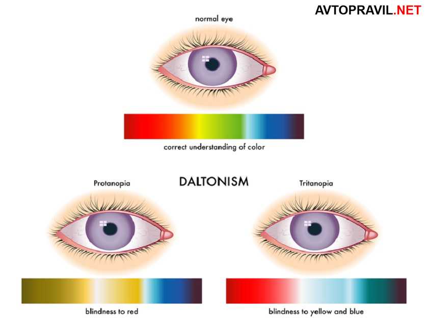 Дальтонизм схема глаза