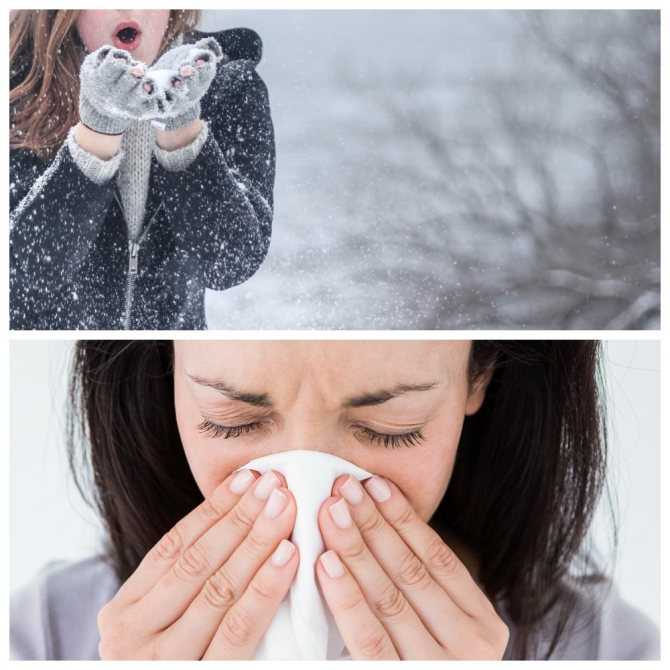 Проявлять холод. Сезонная аллергия на холод.